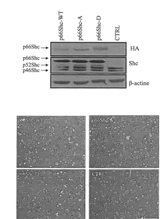 Figure 3 : Expression de p66Shc exogène dans les cellules DLD-1 suite  à  l'infection virale  (A)  Expression protéique de la forme exogène de p66Shc dans les cellules DLD-1, infectées  avec  des  rétrovirus codant soit pour p66Shc-WT,  p66Shc-A,  p66Shc-D