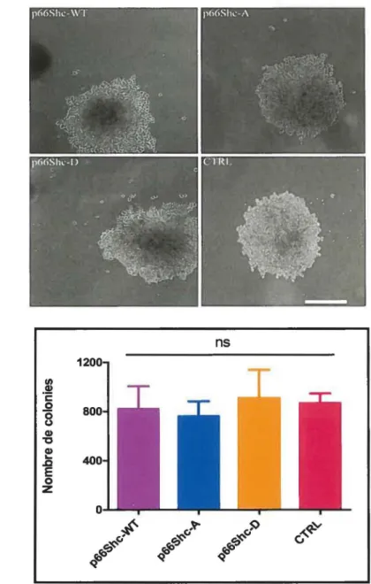 Figure 5 : La réexpression de p66Shc dans les DLD-1 n'influence pas la croissance sans  ancrage  à  la matrice extracellulaire des cellules 