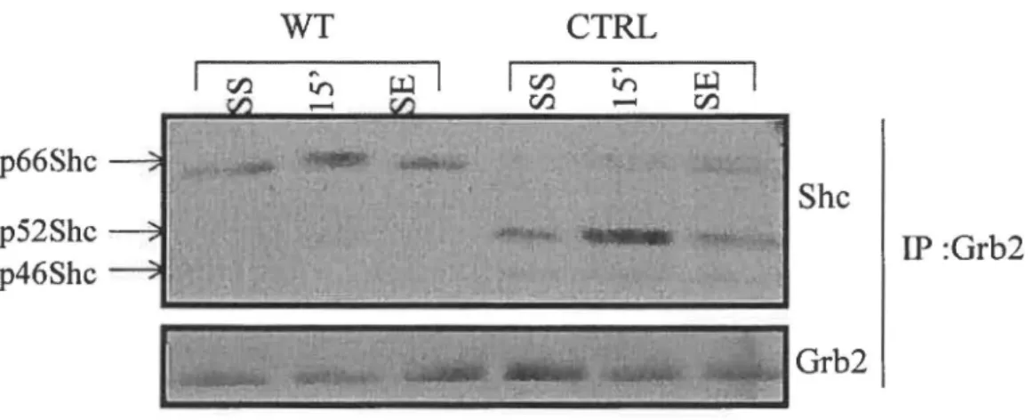 Figure 9 : Perte de l'interaction entre p52Shc et Grb2 en présence de p66Shc dans les  cellules  DLD-1 
