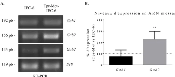 Figure 7 : L’ARN messager de Gab1 et Gab2 sont exprimés dans les cellules IEC-6 et  Tpr-Met-IEC-6