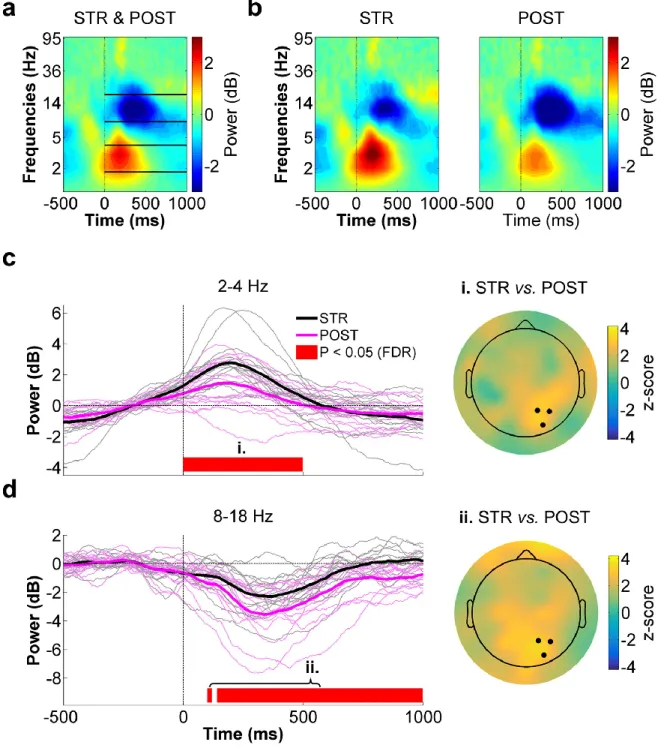 Figure 4.4 - Right parietal ROI time-frequency data for STR vs. POST.  