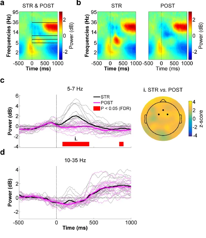 Figure 4.8 - Mid-frontal ROI time-frequency data for STR vs. POST. 