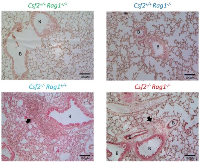Figure  7:  Les  souris  C57BL/6  Csf2-/-Rag1+/+  et  Csf2-/-Rag1-/-  ont  des  larges foyers d’inflammation pulmonaire