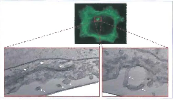 Figure  4 :  Structure  des  invadopodes.  Le  panneau  supérieur  représente  une  cellule  marquée à  la phalloïdine  et  analysée  par microscopie à  fluorescence