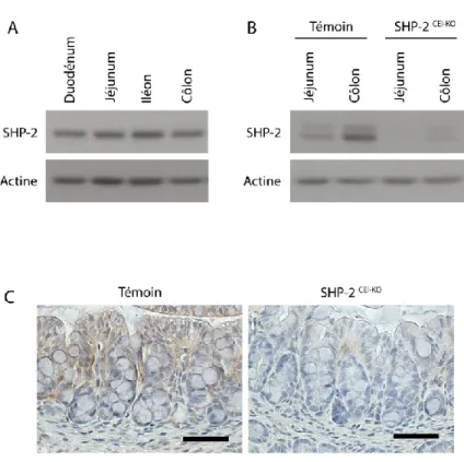 Figure 1: Validation de la perte d’expression de SHP-2 dans les cellules épithéliales intestinales chez les  souris expérimentales