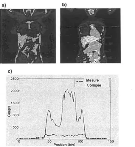 Figure  2.  a)  Image  d'émission TEP  mesurée  avec  le  18 F-fluorodéoxyglucose (FDG)  d' une  section  coronale du corps entier humain non corrigée pour !' atténué et le diffusé, et b) la même image corrigée  pour !'atténué et le diffusé