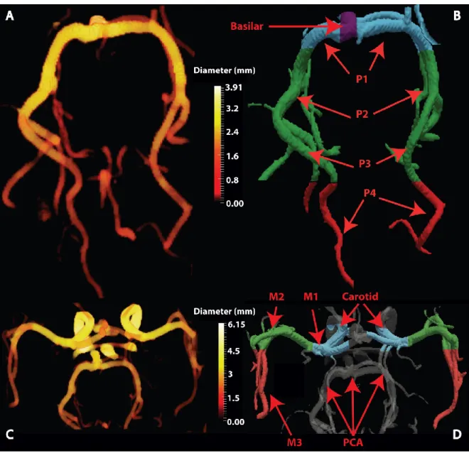 Figure 1. 3D surface of the reconstructed cerebral vessels for PCA (a-b) and MCA (c-d)