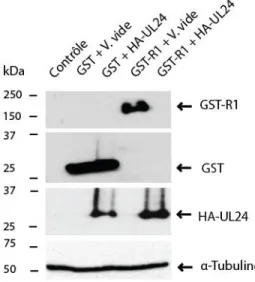 Figure 9: Effet d’HA-UL24 sur l’étiquette GST.  Analyse par immunobuvardage des protéines récoltées  de  cellules  COS-7  transfectées  pendant  48h  avec  les  plasmides  pLBPfl-GST  +  pLBPfl,  pLBPfl-GST  +  pLBPfl-HA-UL24,  pLBPfl-GST-R1  +  pLBPfl,  p