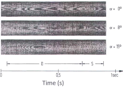 Figure 15.  Fundus pulsations measured with  modified homo dyne interferometry(52). 