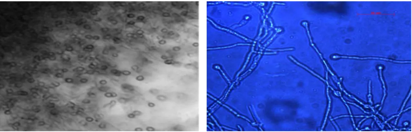 Figure 2  Photomicrographies de Trichoderma viride 
