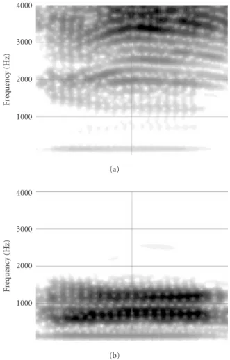 Figure 5: (a) Spectrogram of the /di/ and /da/ mixture. (b) Spectro- Spectro-gram of the sentence “I willingly marry Marilyn” plus siren mixture.