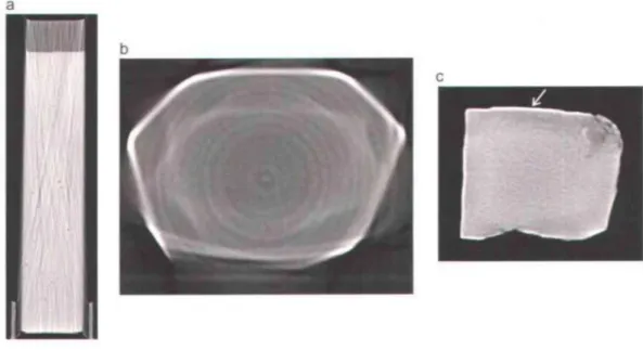 Figure  1.7  : Artéfacts en scanographie médicale: a) les stries, b) les anneaux, c) et le durcissement  du faisceau (flèche)