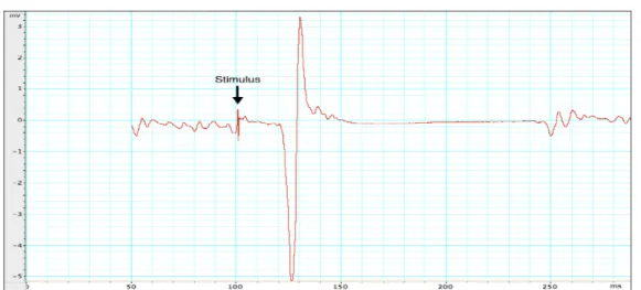 Figure 4. Démonstration de la mesure CSP 