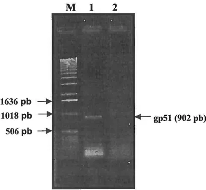 FIGURE 4:  Profil électrophorétique  sur gel d'agarose de  l'amplicon gp51. 