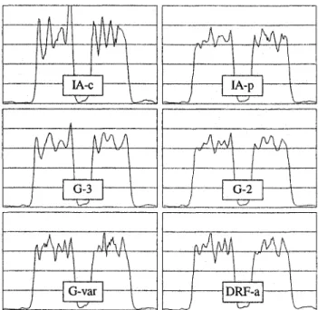 Figure 5:  Profiles  of the  resolution  phantom  (first  reconstruction  series); direction marked with arrows in Figure 4