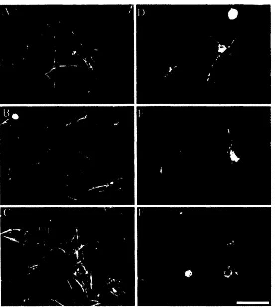 Figure 2.8: Human fibroblasts project a dendritic network o f extensions in collagen matrices but  not on collagen-coated cover slips