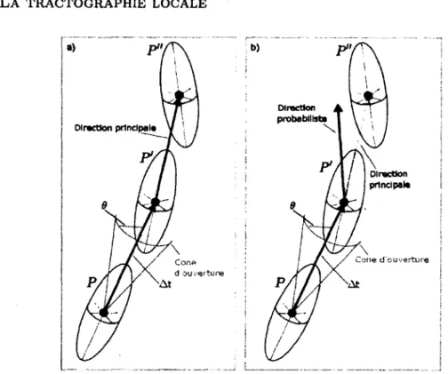 figure 2.2 -  Tractographie locale sur  tenseur de diffusion.  La direction principale est  le vecteur  propre ei associé  à la valeur propre la plus grande