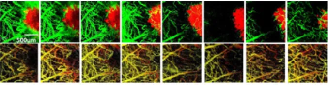 Figure 1: Longitudinal optical imaging of an irradiated  tumor using fluorescence confocal microscopy (top: 