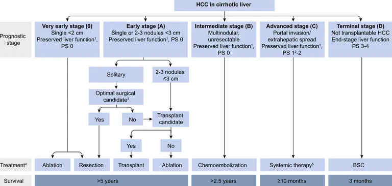 Fig. 3. Modified BCLC staging system and treatment strategy. 1 ‘‘Preserved liver function” refers to Child-Pugh A without any ascites, considered conditions to obtain optimal outcomes