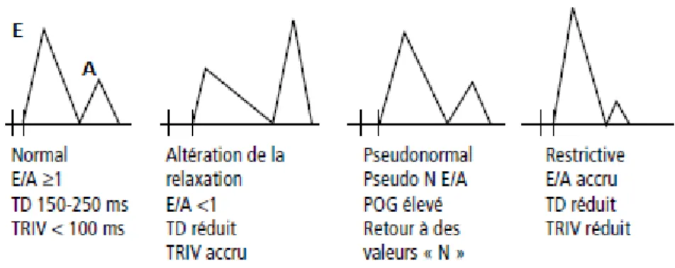 Figure 9:Diagramme schématique représentant lesschémas de vitesse du remplissage 