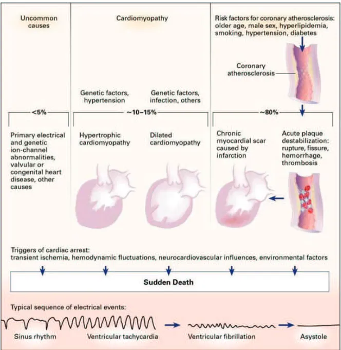 Figure  2 :  Physiopathologie  et  épidémiologie  de  la  mort  subite  d’origine  cardiaque,  d’après Heikki