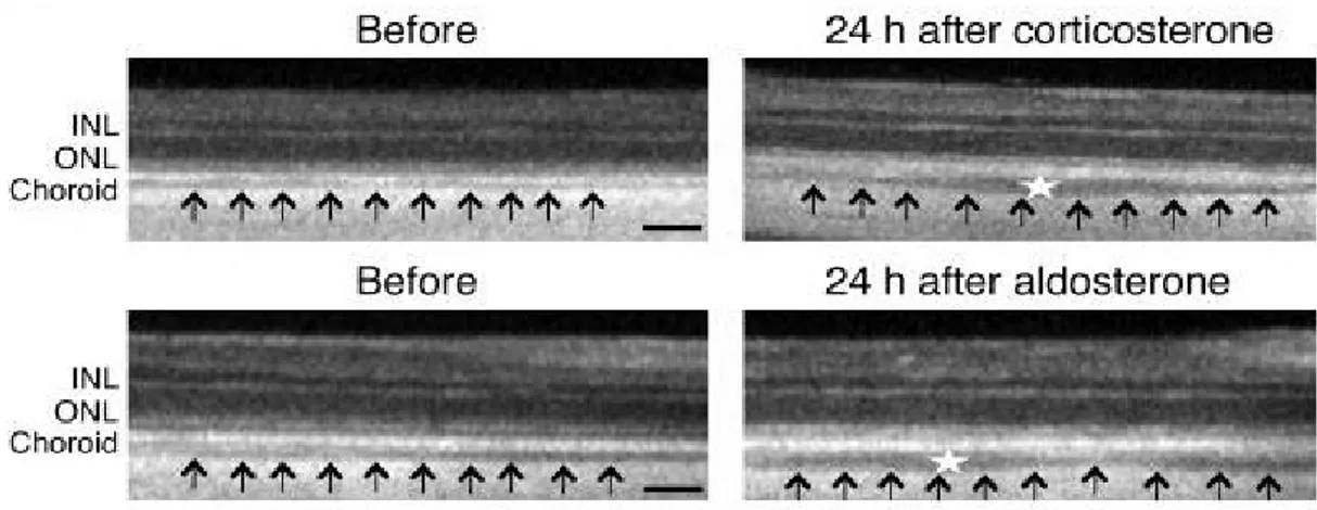 Figure 1 : coupes OCT de rétines de rats avant et 24h après une IVT de corticoïdes fortes doses ou d'aldostérone : épaisissement choroïdien ( flèches ) et dilatation des vaisseaux choroïdiens (53)