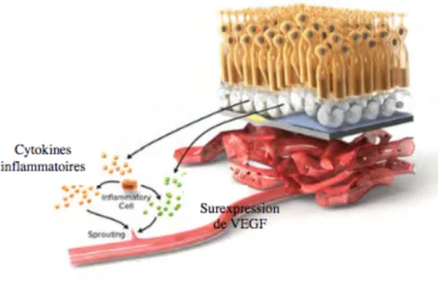 Figure 3 : Inflammation et surexpression de VEGF. 