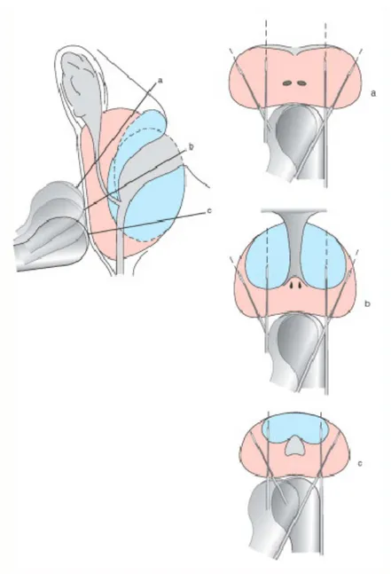 Figure 3 : Schéma des biopsies prostatiques  [ 10 ]