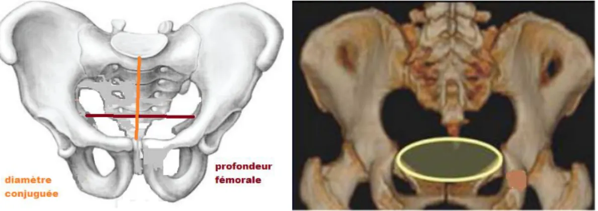 Figure 9 : Représentations schématique et virtuelle de la MPA 