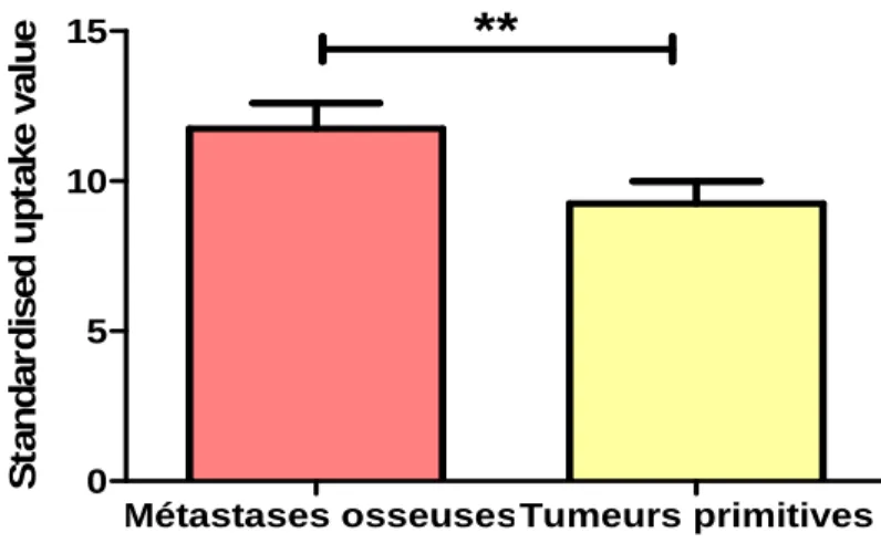 Figure 3 : Localisations des tumeurs primitives présumées à la TEP au  18 FDG 