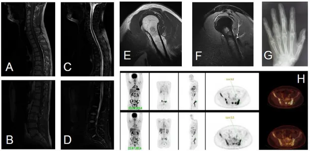 Figure  1.  Images  typiques  recueillies  à  l’IRM,  au  TEP-scanner  au  18-FDG  et  en  radiographie