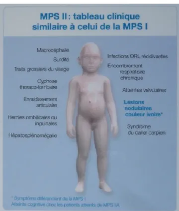 Figure 5 : Tableau clinique de la MPSII 