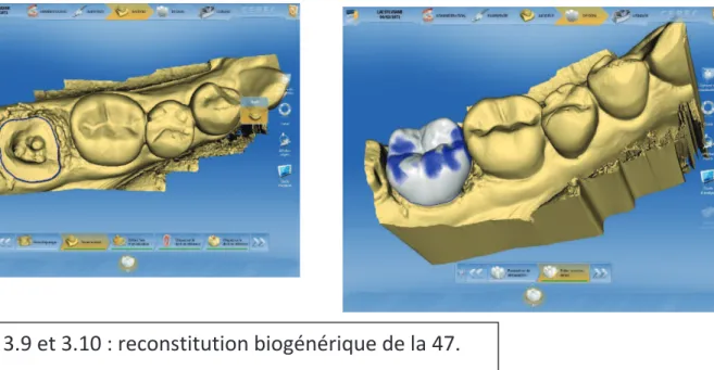 Fig. 3.9 et 3.10 : reconstitution biogénérique de la 47. 