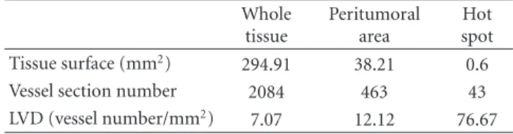 Table 1: LVD quantification in the whole cervical cancer tissue and peritumoral area assessed by the automated lymphatic vessel detection method in comparison with hot spot method described by Weidner and colleagues [12].