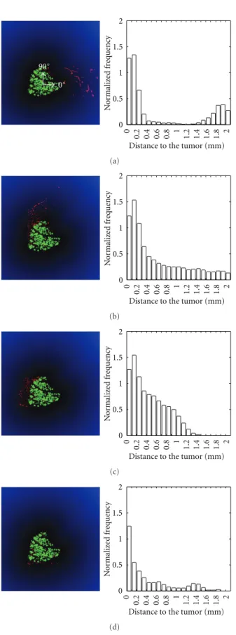 Figure 5: Euclidean distance function applied to the region of interest around the tumor