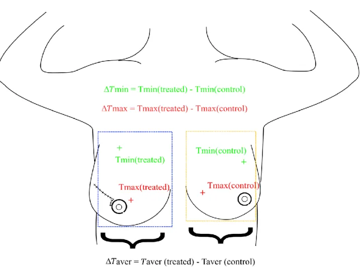 Figure 1: Measurement of Temperature differences. Example of lumpectomy. 