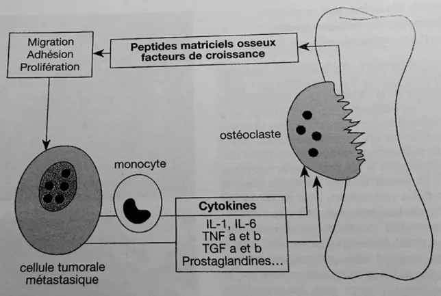 Figure 6 : Physiopathologie de la métastase osseuse (Marcelli), Cancer secondaire  des os : Expansion scientifique française 1997  29