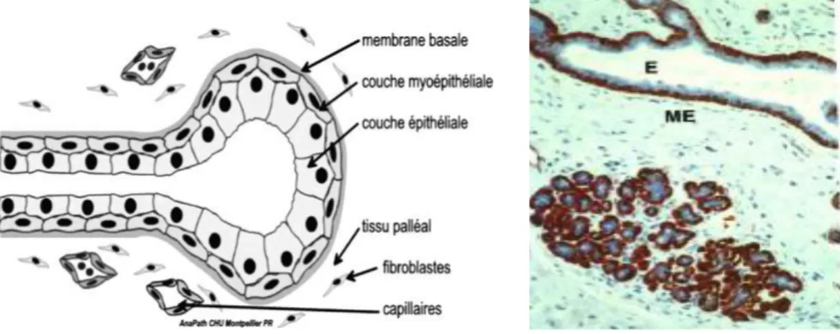 Figure 3 : Schéma d’un acinus et immunomarquage antimusculaire lisse à droite objectivant la  double assise cellulaire épithéliale (E) et myoépithéliale (ME) (Service anatomopathologie, 