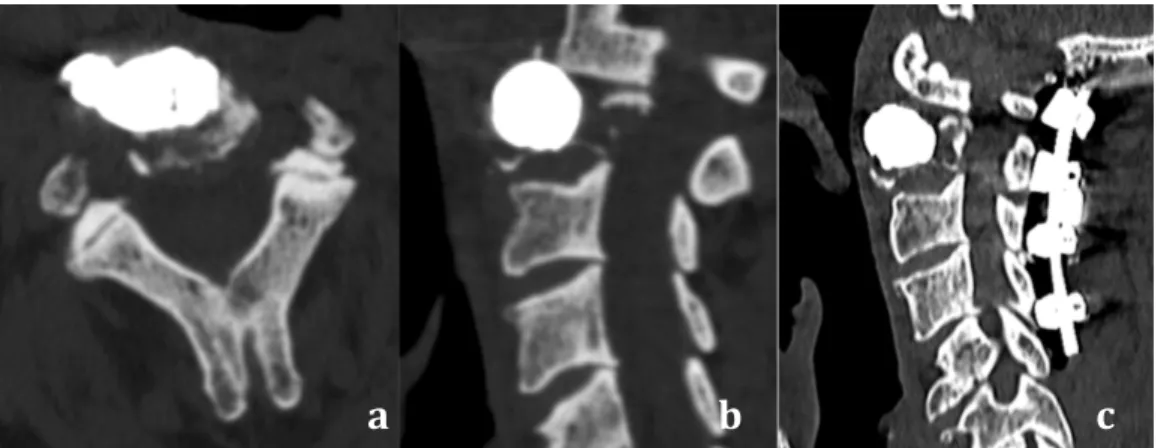Figure 6 : Complication et prise en charge 