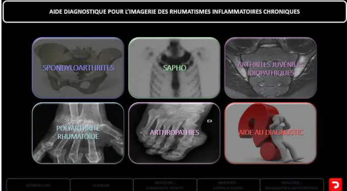 Figure 3 : Rhumatismes inflammatoires chroniques 