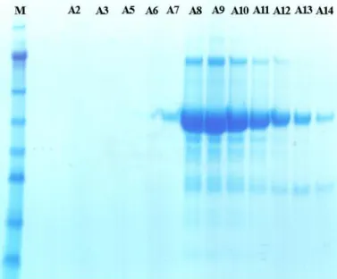 Figure 18 - SDS-PAGE gel after the size-exclusion column. On this gel were loaded the samples named after the fractions  of the size-exclusion column