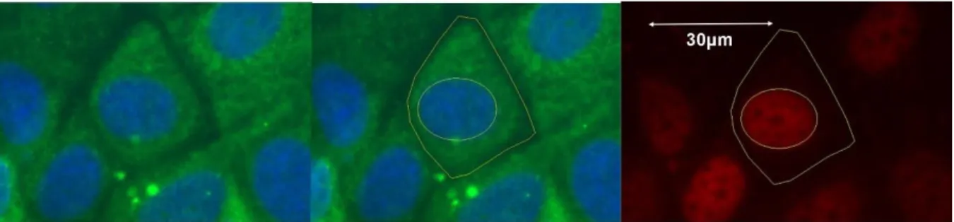 Figure  1 :  Méthodologie  employée  pour  déterminer  la  surface  cellulaire  et  l’intensité  protéique au sein du noyau