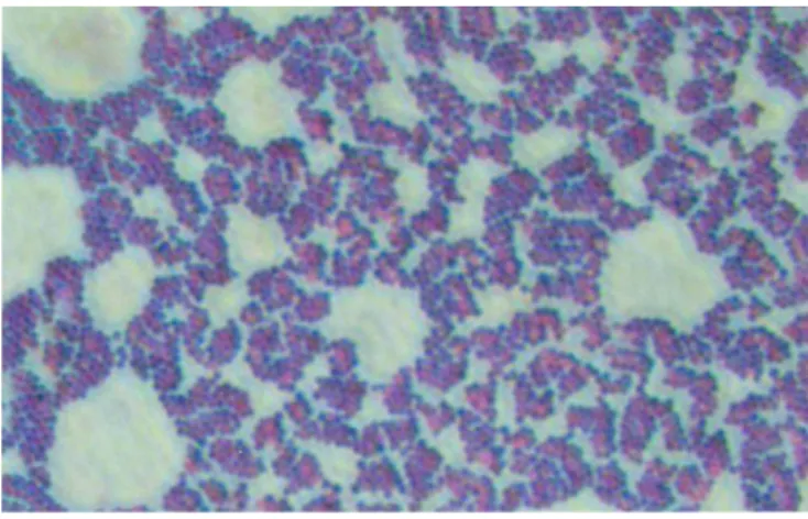 Figure 1 : Amas de S. aureus après coloration de Gram. Microscopie optique (x100). Picture book to the  microbiology (2005), Seoul National University