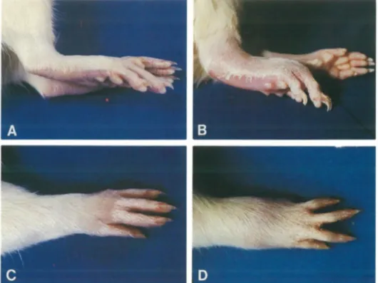 Figure 11. Arthrites périphériques développées dans la SpAr.   