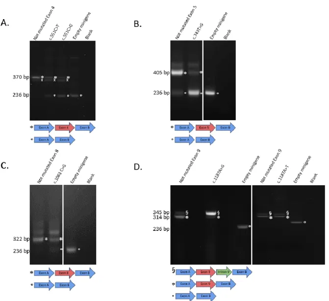 Figure 2: Missense CAPN3 variants with splicing defects in the minigene assay (exon skipping)