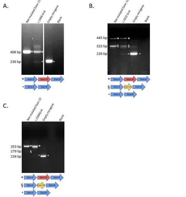 Figure 3: Missense CAPN3 variants with splicing defects in the minigene assay (other types of splicing  abnormalities)
