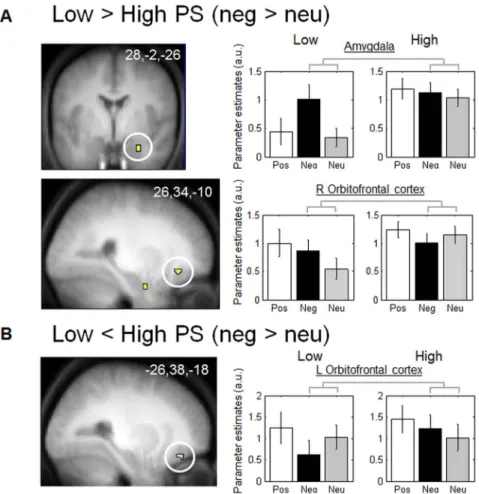 Figure 1. Functional MRI responses to negative vs. neutral pictures. A: Brain regions significantly more activated in low PS subjects compared to high PS subjects