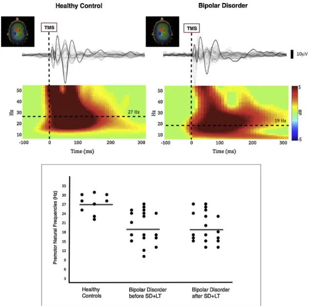 Fig. 1. Top panel: average EEG responses to TMS (grey traces represent the 60 recording channels) for the channel closest to the stimulation site (black trace) over the premotor area; color-coded: event-related spectral perturbation (ERSP) plots reﬂect the