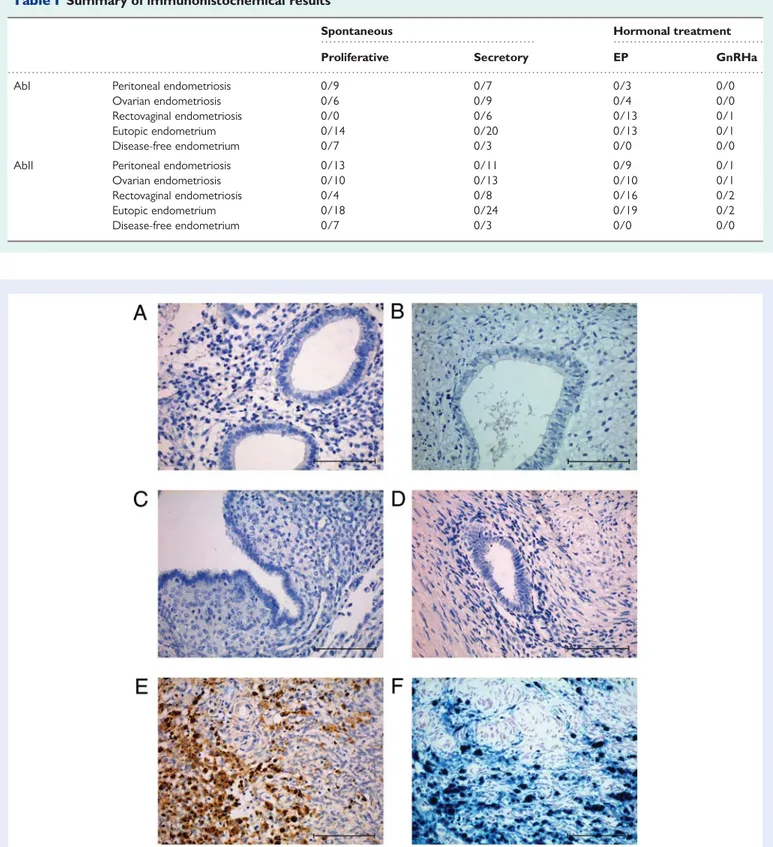 Figure 2 Aromatase immunohistochemistry of human endometrium and endometriotic lesions, and iron deposit staining.