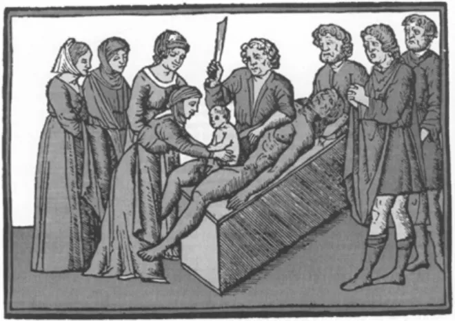 Figure 6 : Représentation médiévale de la naissance de Jules César. Suetone,  La Vie des Douze Césars, 1506